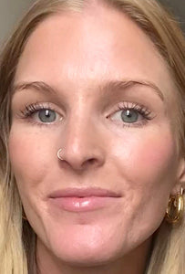 MACRENE actives Face Serum Before and After